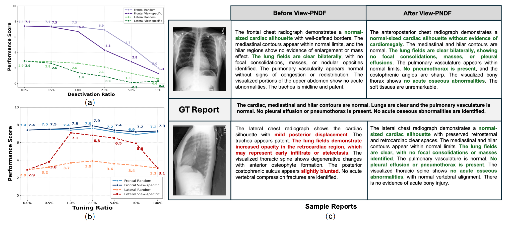 Ablation studies of VND, VNV, and VNF on MIMIC-CXR